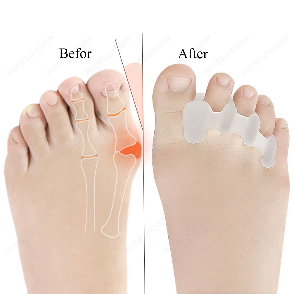 Toe Protective Toes Separator  – Toe Separator Silicon recenzja i cena