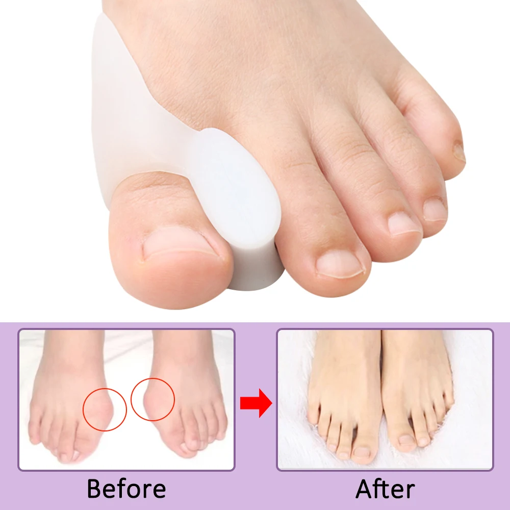 2/4/8Pcs Spacer Gel Big Bunion – Toe Separator Silicon recenzja i cena